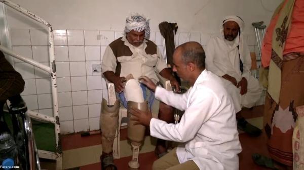 جنگ یمن و افزایش تقاضای اندام مصنوعی